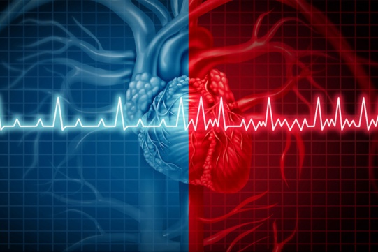 zapis ekg