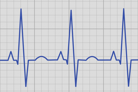 zapis ekg