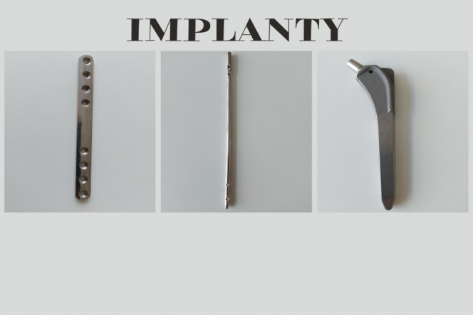 Implanty